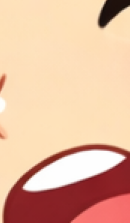 앞니 라미네이트 시술이 고민된다면 관련 이미지 32