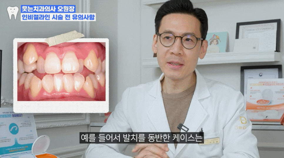 투명교정가격? 강남투명교정 가격대는 관련 이미지 5