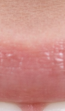 What should you be sure to check before deciding on Gangnam laminate dentistry? image 28