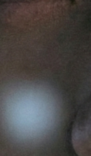 논현역교정치과 선택 전 반드시 확인해야 할 체크 포인트 관련 이미지 36