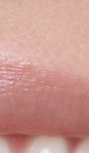 What should you be sure to check before deciding on Gangnam laminate dentistry? image 30