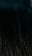 논현역교정치과 선택 전 반드시 확인해야 할 체크 포인트 관련 이미지 26