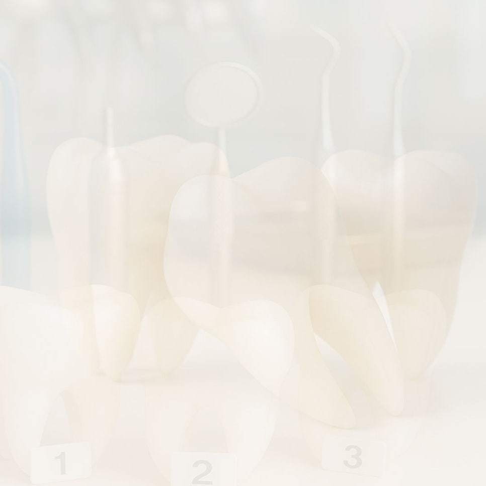 무삭제 라미네이트 후기 꼼꼼히 찾아봤어요 관련 이미지 17