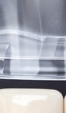 40대 치아 교정 고민 중이라면? 부담 줄이고 효율 높이는 선택법 관련 이미지 38