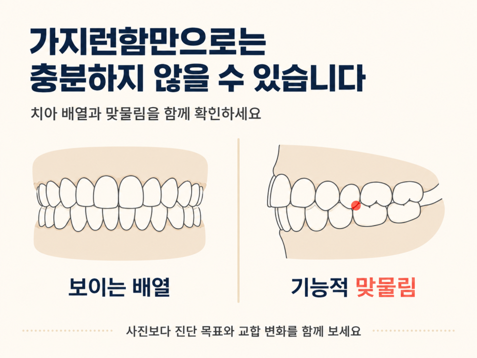 강남교정전문치과 선택 전, 투명교정 상담에서 꼭 확인하세요 관련 이미지 7