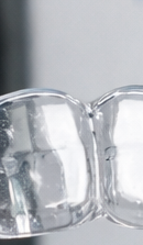 강남 교정전문의치과 고민된다면 관련 이미지 28