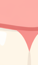 신사역 치과 추천 찾아본다면 관련 이미지 31