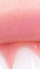 What to Check Before Choosing a Gangnam Laminate Dental Clinic image 29