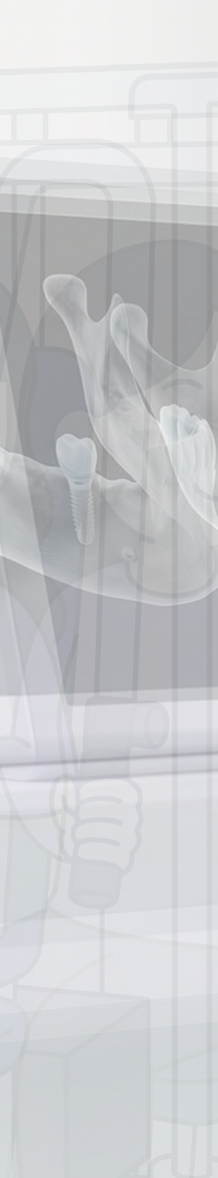 Invisalign Retainer Duration: A Detailed Look image 17