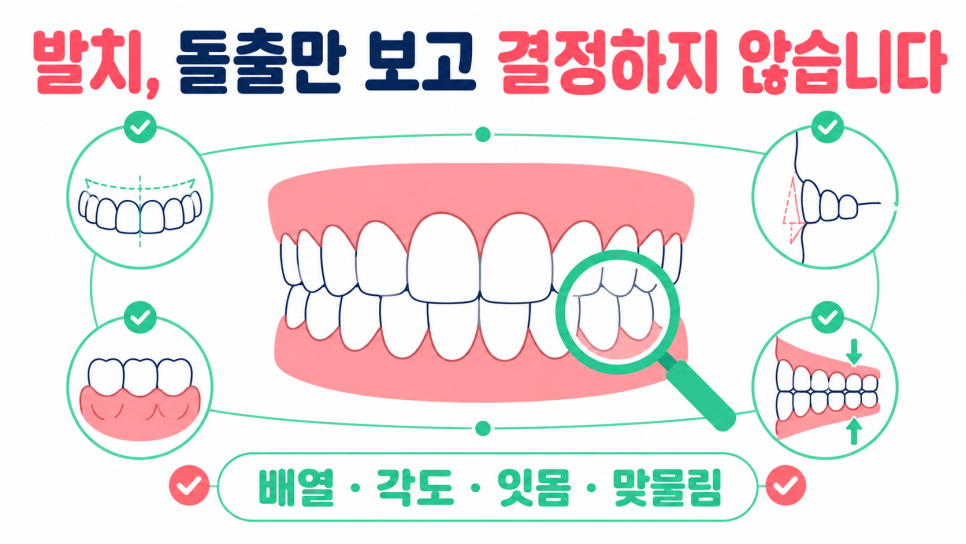 강남교정치과, 교정 종류보다 먼저 살펴야 할 선택 기준은? 관련 이미지 3