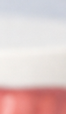 성인 돌출입 교정, 발치 없이도 변화가 가능할까? 관련 이미지 32