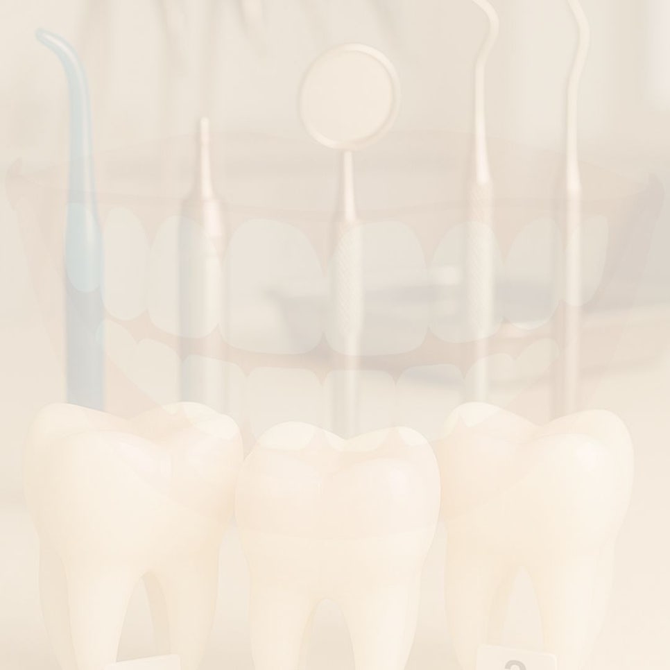 무삭제 라미네이트 후기 꼼꼼히 찾아봤어요 관련 이미지 32