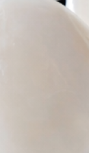 서울교정치과 선택 전 확인해야 할 정밀 진단 기준 관련 이미지 24