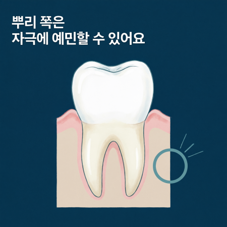 스케일링 후 이시림, 며칠이나 시린가요? 관련 이미지 4