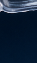 강남교정치과 결정 전 고려할 사항은 관련 이미지 37