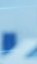 돌출입 교정 기간 줄일 수 있을까? 기간 단축을 돕는 핵심 요소 관련 이미지 34