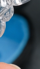 강남 교정전문의치과 고민된다면 관련 이미지 34