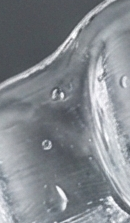 강남교정치과 선택 시 확인해야 할 핵심 기준과 정밀 진단 관련 이미지 36