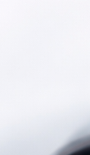 강남 인비절라인 치과 찾고 있다면 관련 이미지 38