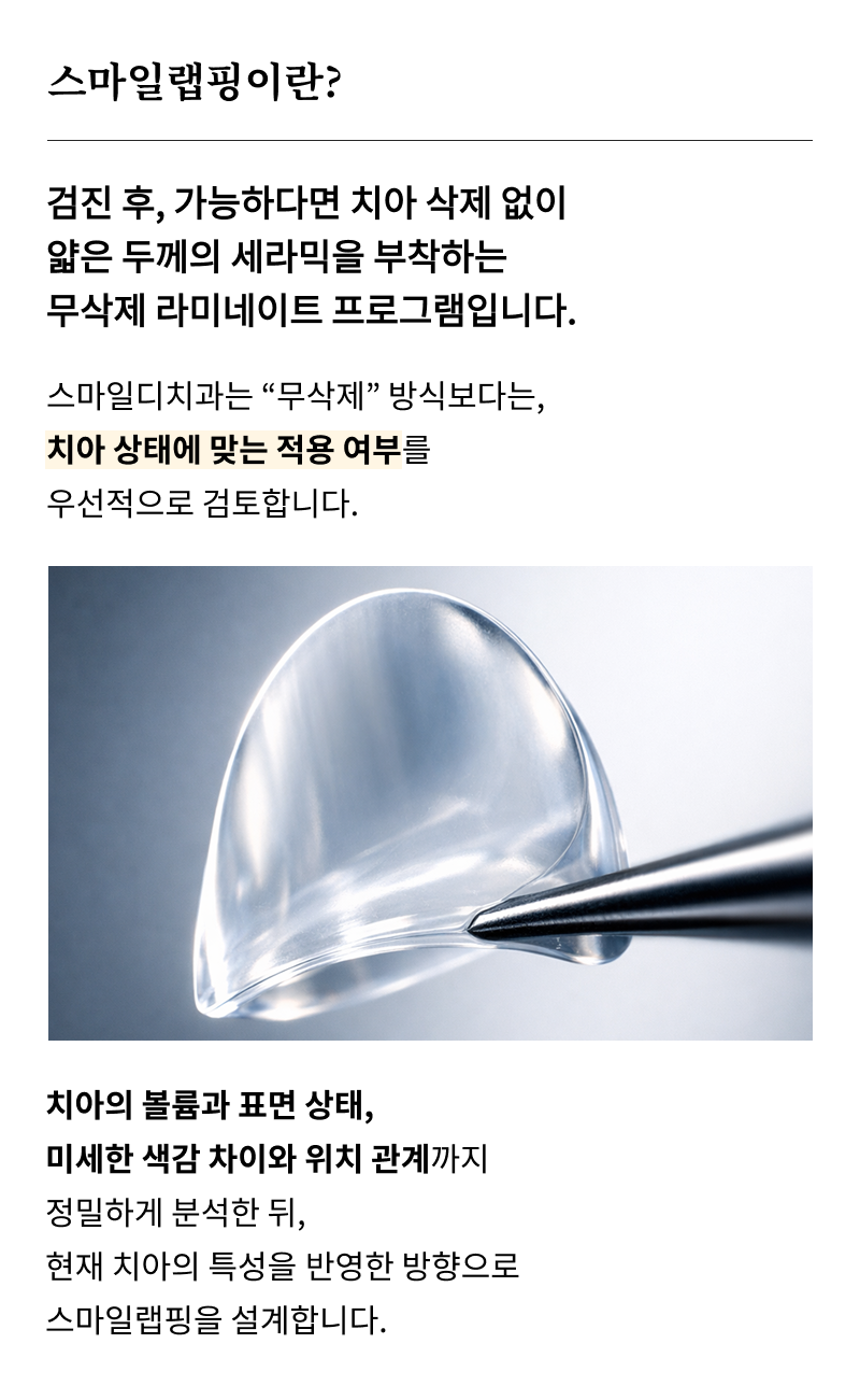 압구정 라미네이트치과 자연스러운 완성을 위한 선택 기준? 관련 이미지 10
