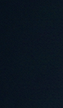 강남 교정치과 고를 때 놓치기 쉬운 판단 기준 관련 이미지 29