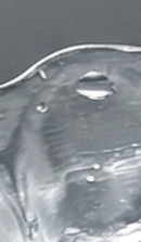 강남교정치과 선택 시 확인해야 할 핵심 기준과 정밀 진단 관련 이미지 30