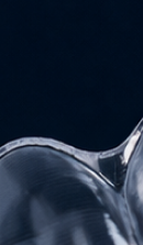 강남교정치과 결정 전 고려할 사항은 관련 이미지 29