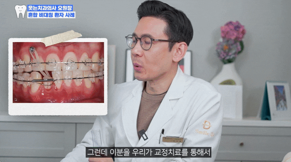 신사역치과 안면비대칭 수술없이 가능할까 관련 이미지 9