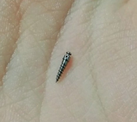 Why Are Invisalign Screws Placed, and How Much Do They Hurt? image 6