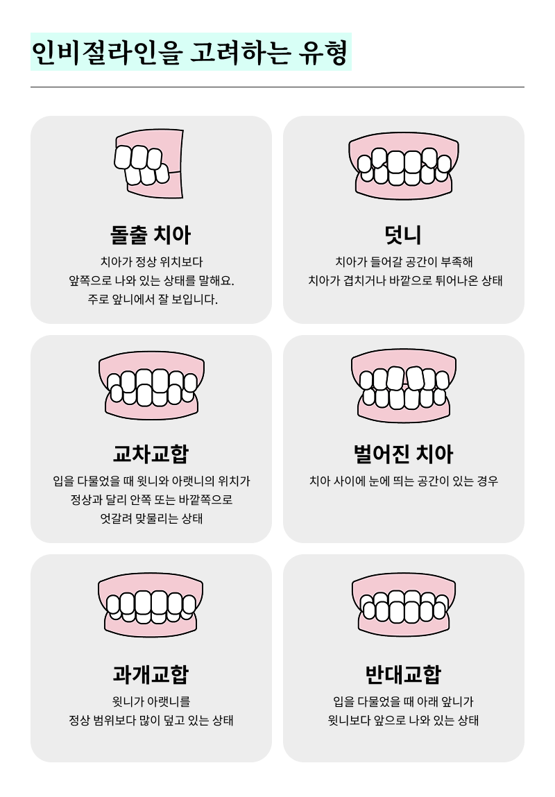 40대 치아 교정 고민 중이라면? 부담 줄이고 효율 높이는 선택법 관련 이미지 14