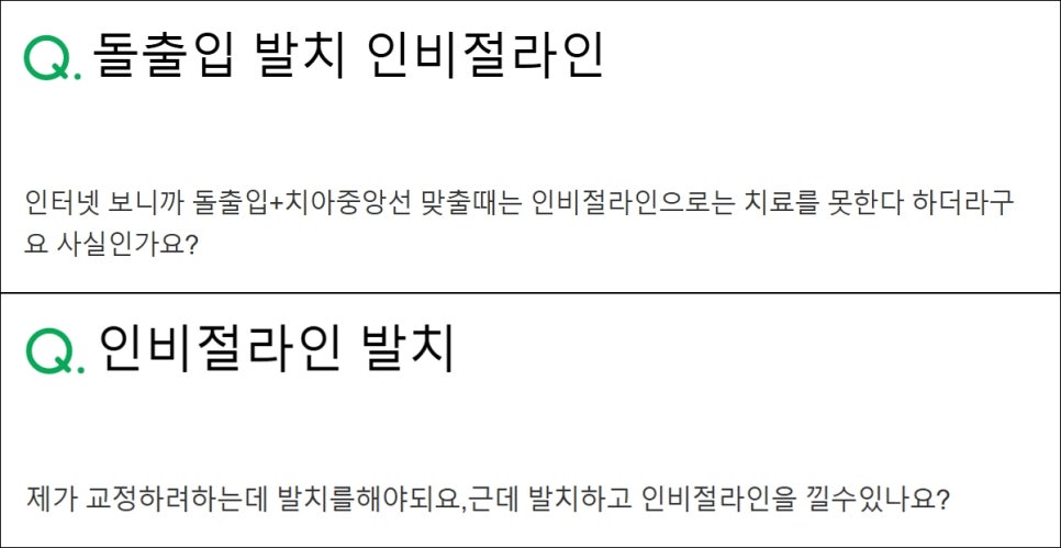 인비절라인 발치 여부에 대한 오해와 진실 알아보기 관련 이미지 4
