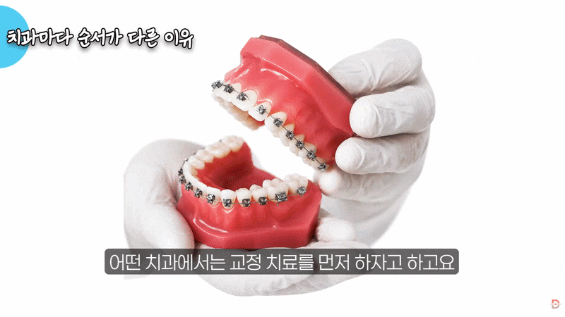 교정 중 임플란트, 치료 순서는 어떻게 정해야 할까요? 관련 이미지 4