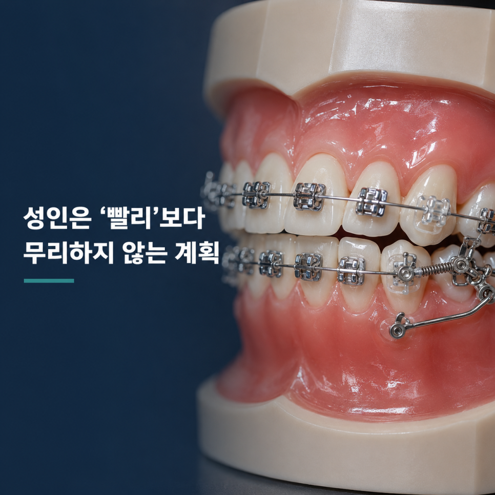 신사역치과, 40대&middot;50대 치아교정 정말 늦은 걸까요? 관련 이미지 9