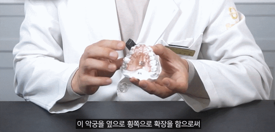 덧니교정 비발치로도 가능할까? 관련 이미지 6