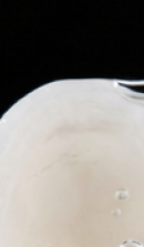 서울교정치과 선택 전 확인해야 할 정밀 진단 기준 관련 이미지 22