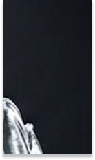 신사역치과 치아교정 전 꼭 확인해야 할 정밀 진단 기준 관련 이미지 33