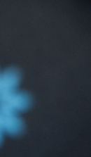 성인 돌출입 교정, 발치 없이도 변화가 가능할까? 관련 이미지 27