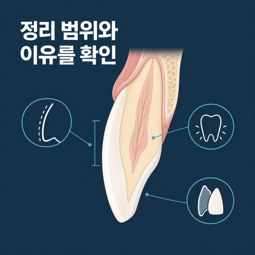 압구정 라미네이트, 후회 없는 선택을 위해 먼저 확인할 것들? 관련 이미지 3