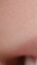 What should you be sure to check before deciding on Gangnam laminate dentistry? image 25