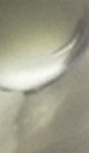 강남무삭제라미네이트치과 선택을 위한 정밀 정보 관련 이미지 29