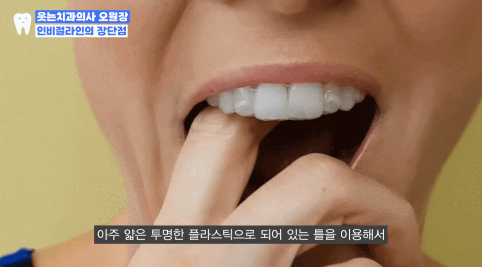 인비절라인 통증, 아이가 견딜까? 인비절라인 퍼스트로 알아본 결과 관련 이미지 4