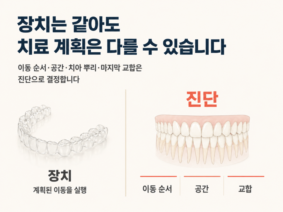 강남교정전문치과 선택 전, 투명교정 상담에서 꼭 확인하세요 관련 이미지 2