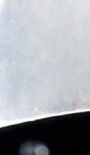 논현역 라미네이트 치과 후회 없는 선택을 위해 체크할 요소들 관련 이미지 29