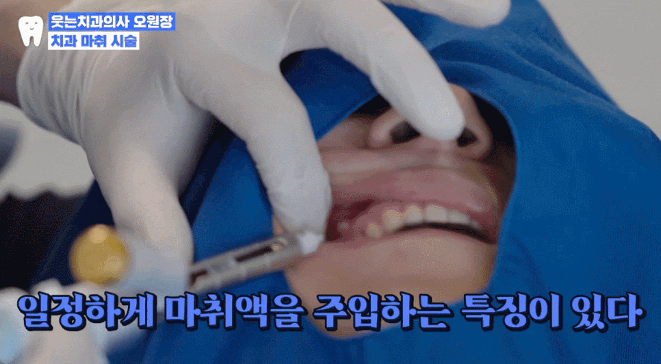 Does a dental anesthetic injection hurt? Tips to make it less painful <Full disclosure> image 5