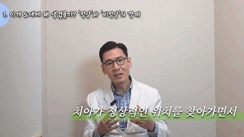 블랙트라이앵글 치료, 강남치과는 어떻게 해결할까? 관련 이미지 7