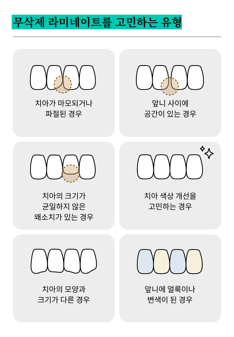 강남무삭제라미네이트치과 선택을 위한 정밀 정보 관련 이미지 15
