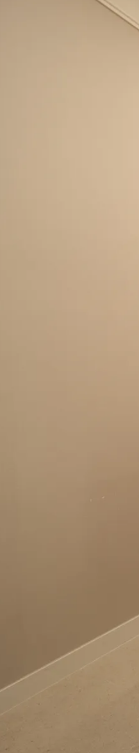 네비게이션 임플란트 식립과정 정확한 계획이 중요한 이유 관련 이미지 32