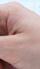 신사역임플란트치과 실패 없는 선택을 위해 관련 이미지 40