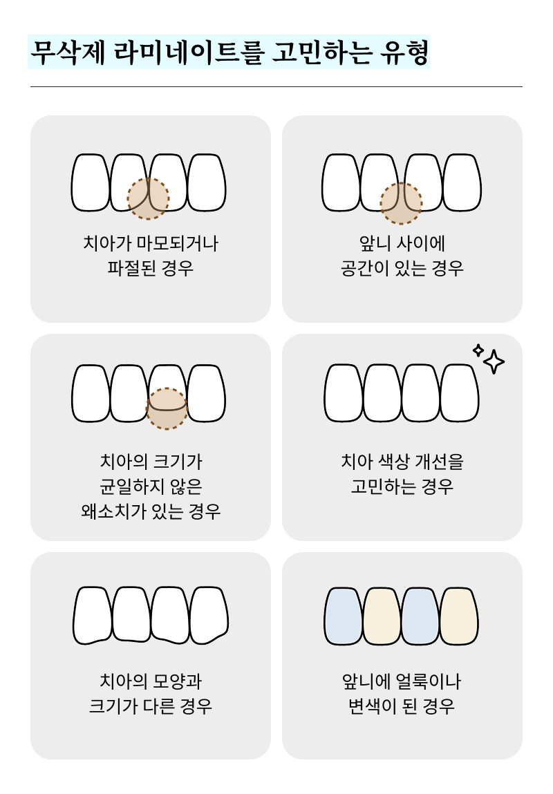 신사역 라미네이트 치과, 자연스러운 미소를 결정짓는 비밀 관련 이미지 14