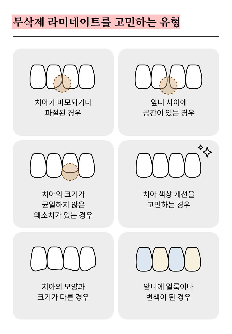 논현역 라미네이트 치과 후회 없는 선택을 위해 체크할 요소들 관련 이미지 14
